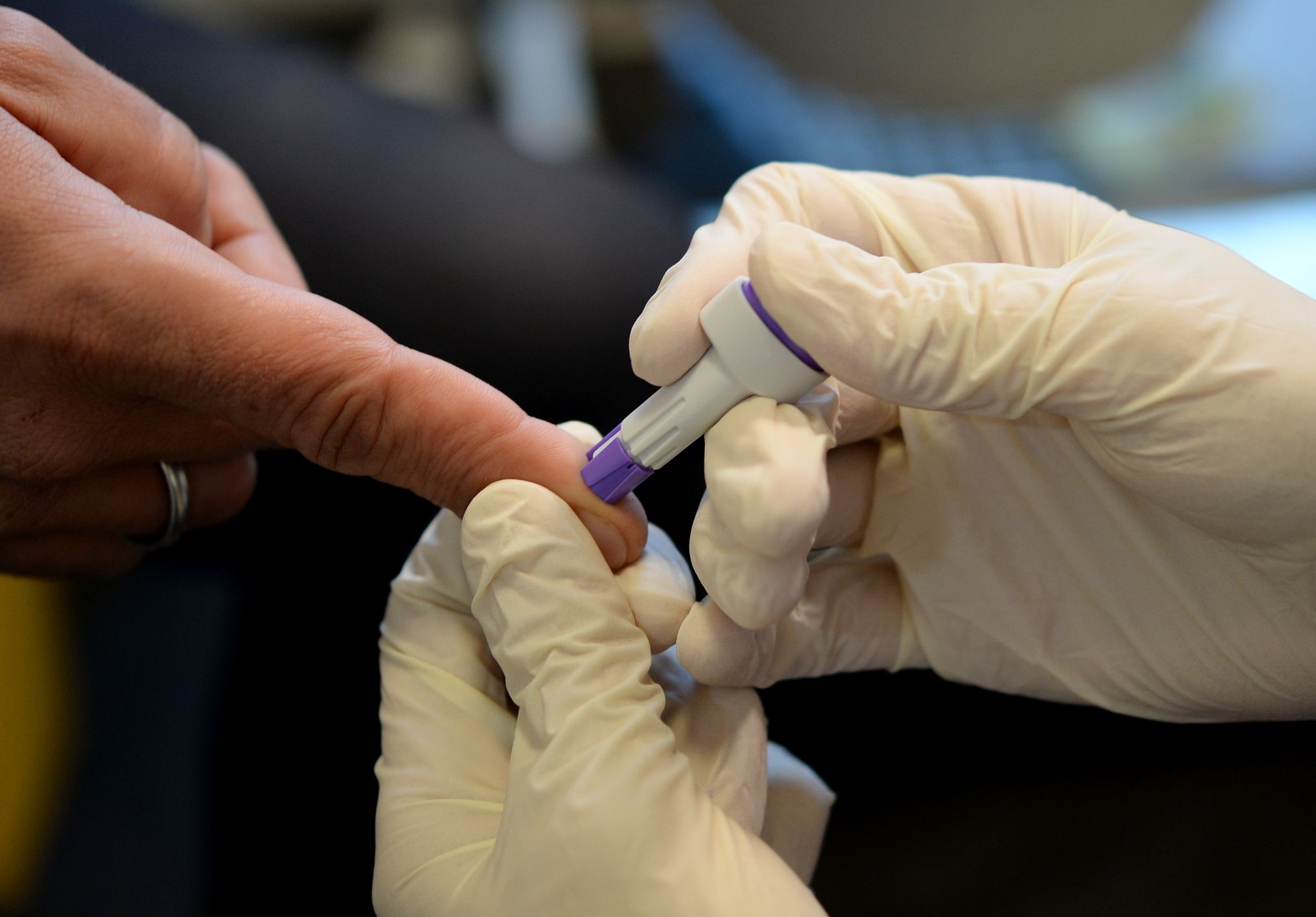 HIV-Positive leben immer noch mit Angst und Stigma