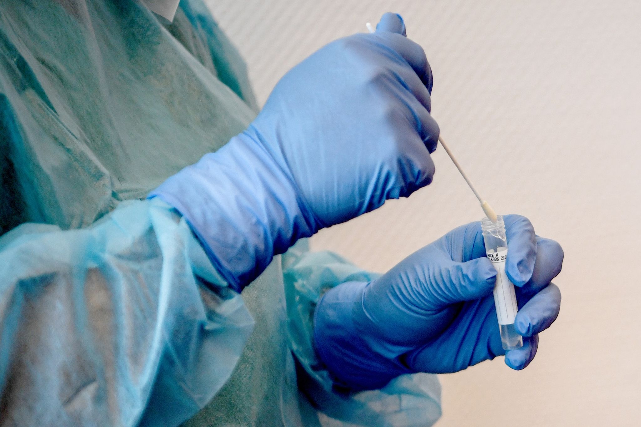 PCR-Tests am besten schon bei leichten Symptomen