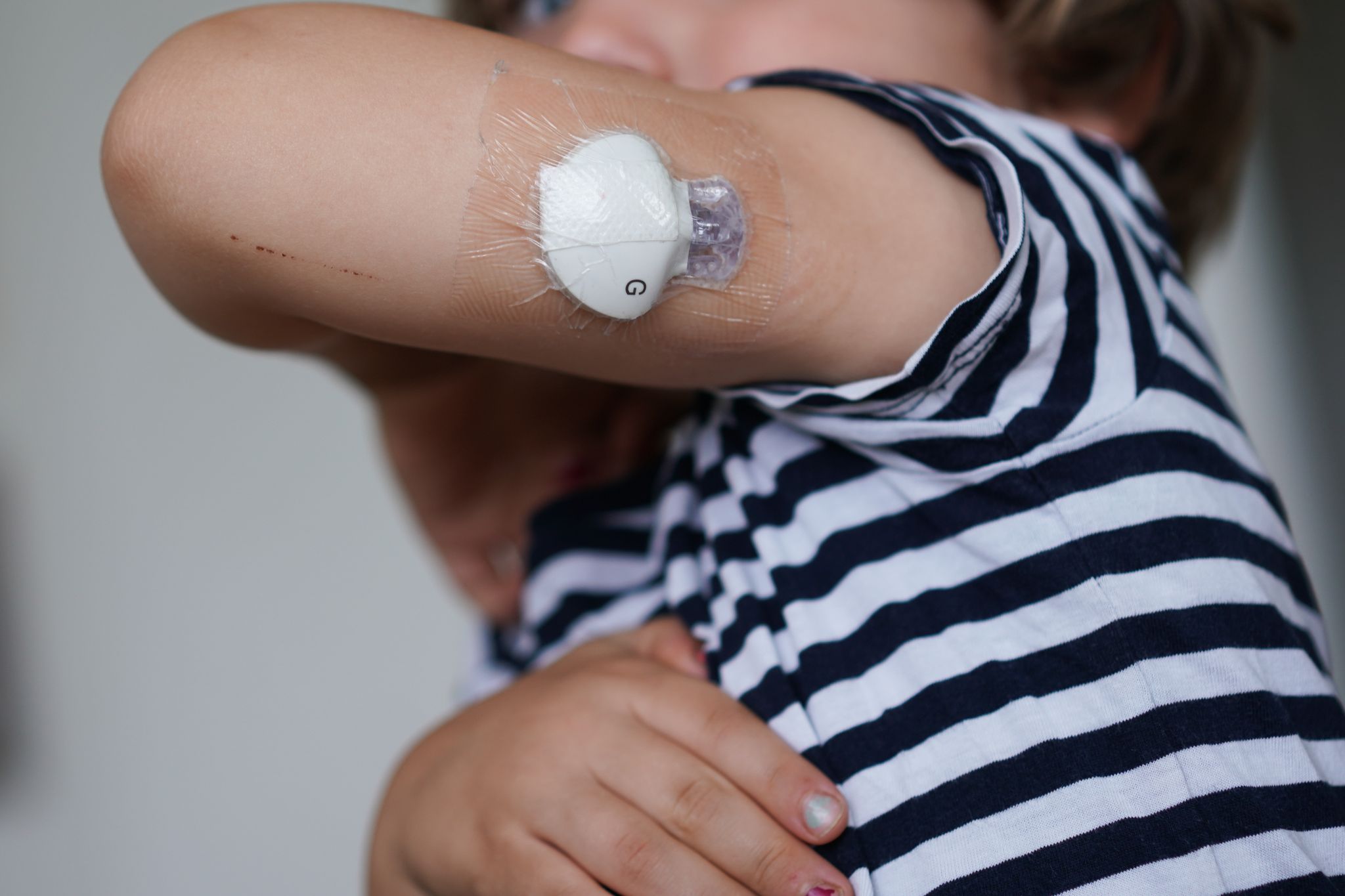Diabetes kann schon die Jüngsten treffen