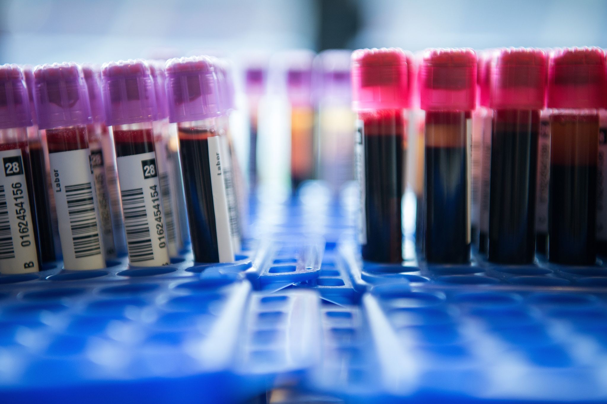 Bluttest soll Vielzahl von Krebsarten erkennen