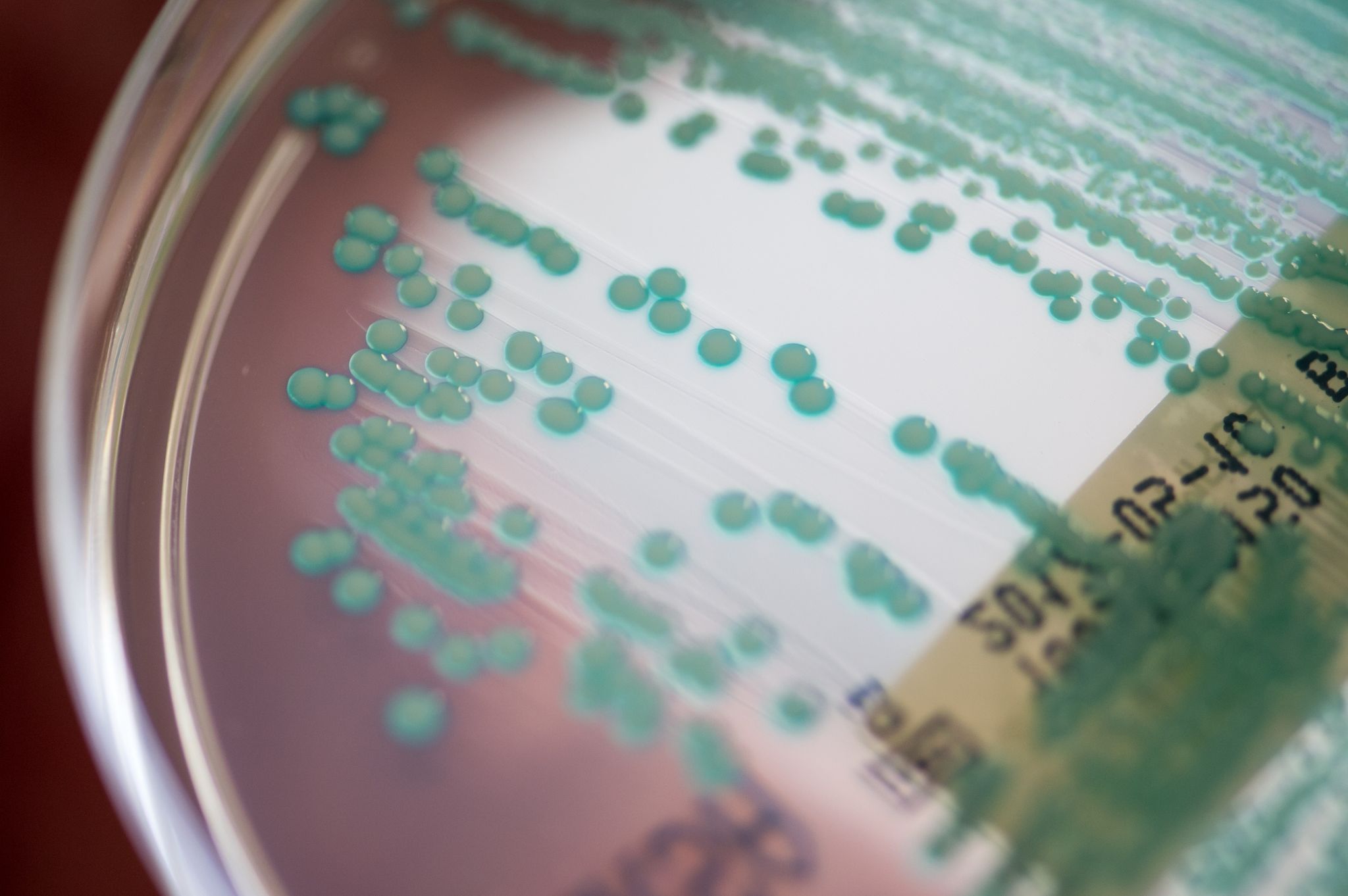 Umwelthilfe: Antibiotikaresistente Keime auf Geflügelfleisch