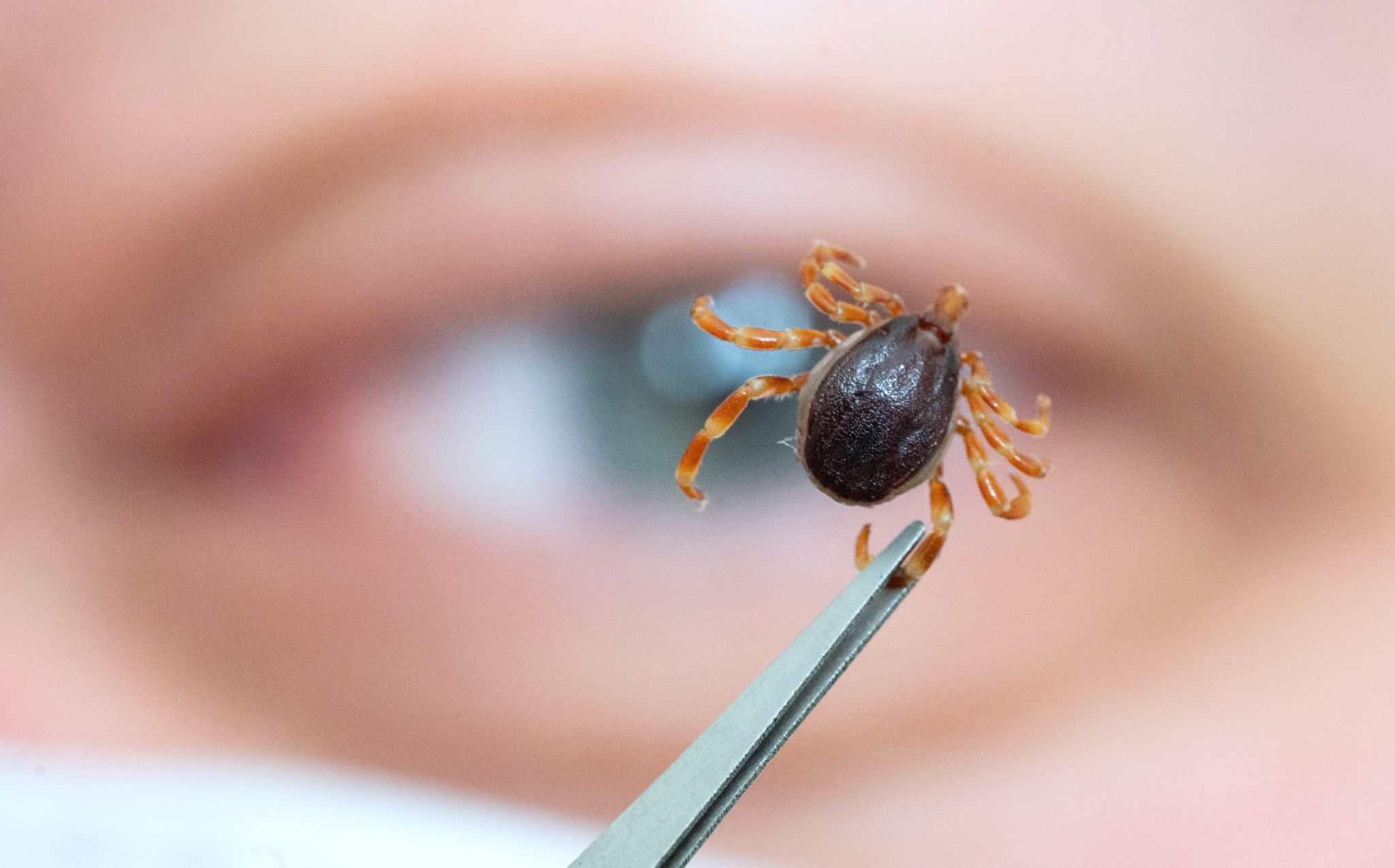 So schützen Sie Kinder vor Zeckenbiss und FSME