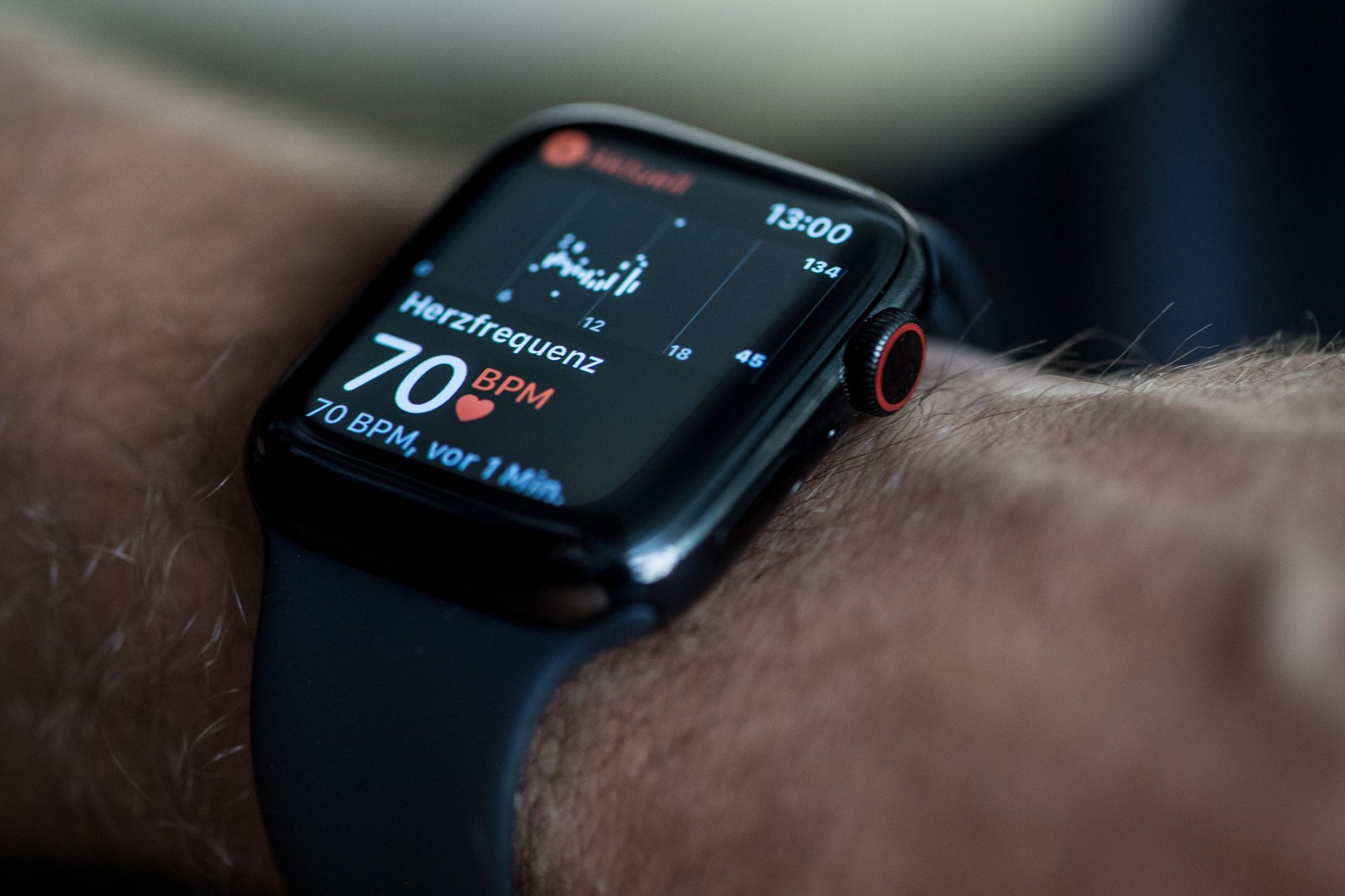 Kann eine Smartwatch Herzprobleme erkennen?