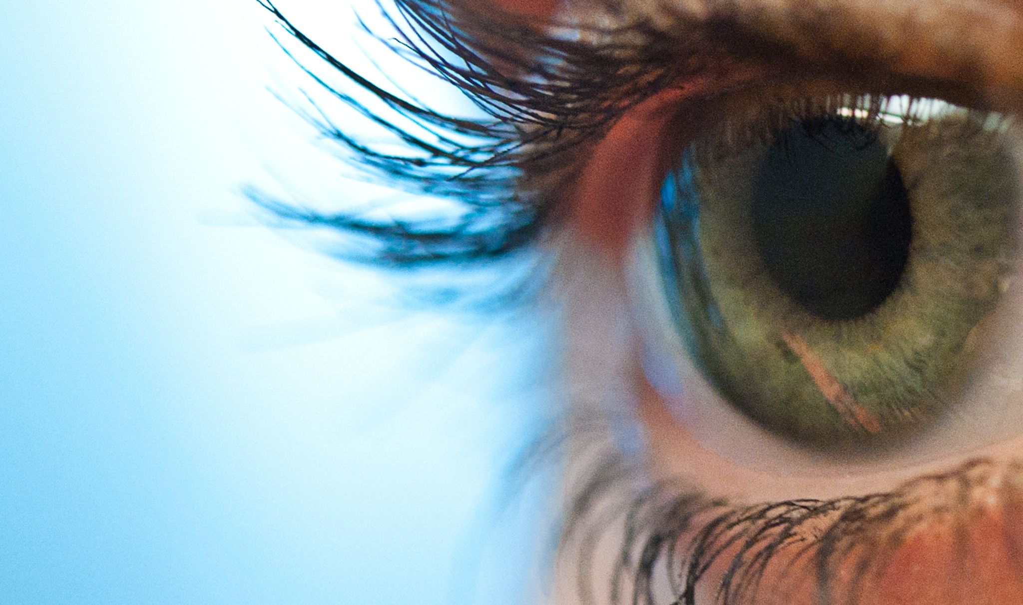 Hinter Schleiersehen kann Thrombose stecken