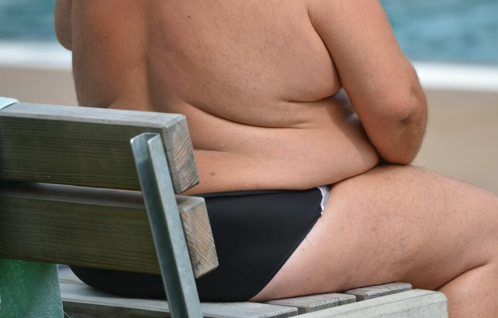 Adipositas: Welche Therapieangebote helfen