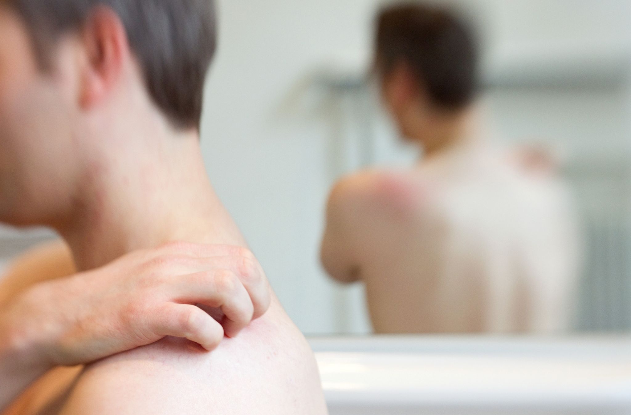 Impfung möglich: Gürtelrose kann Nervenschmerzen verursachen