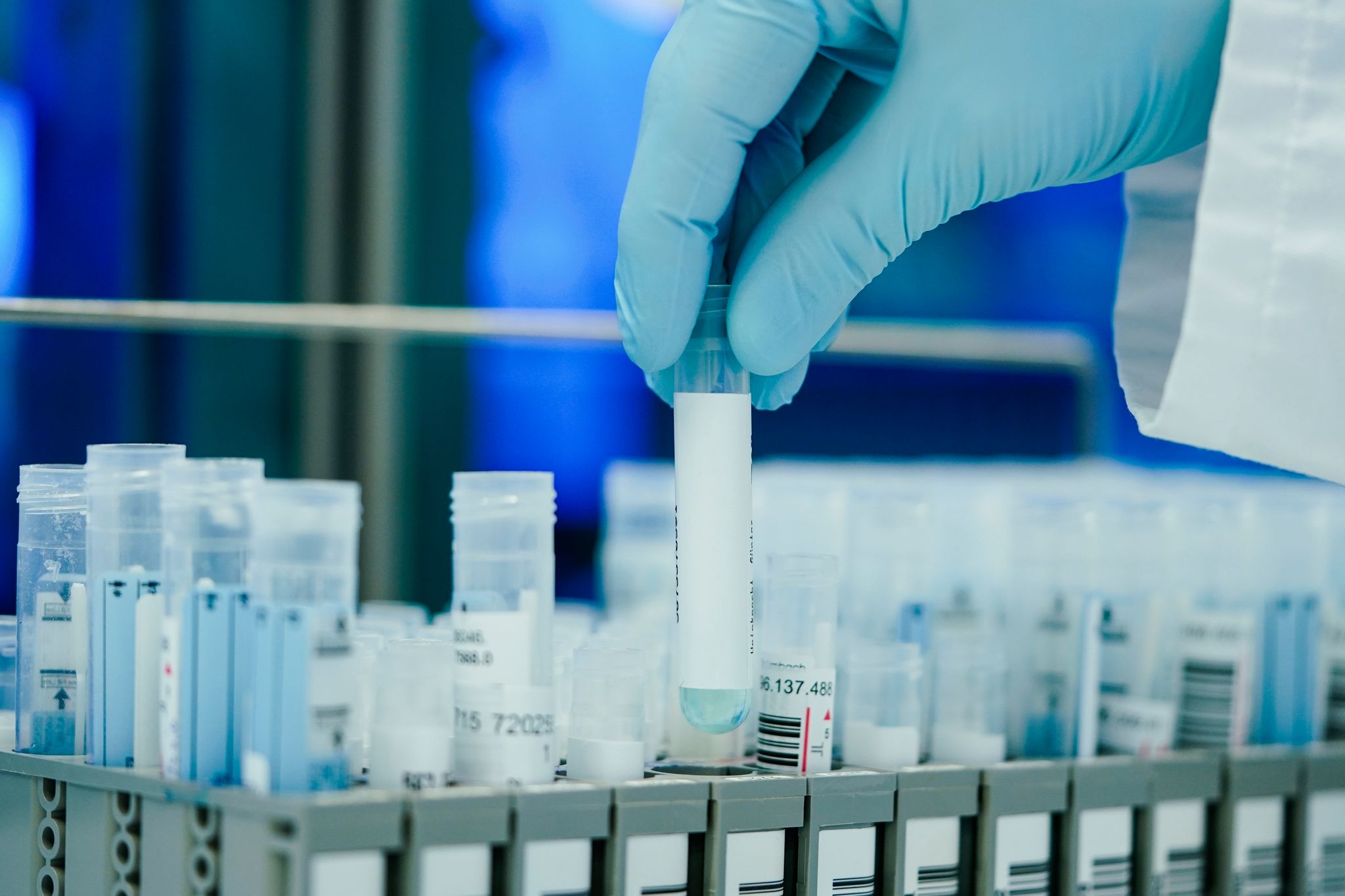 Antikörpertherapien bei Omikron-Variante BQ.1.1 wirkungslos