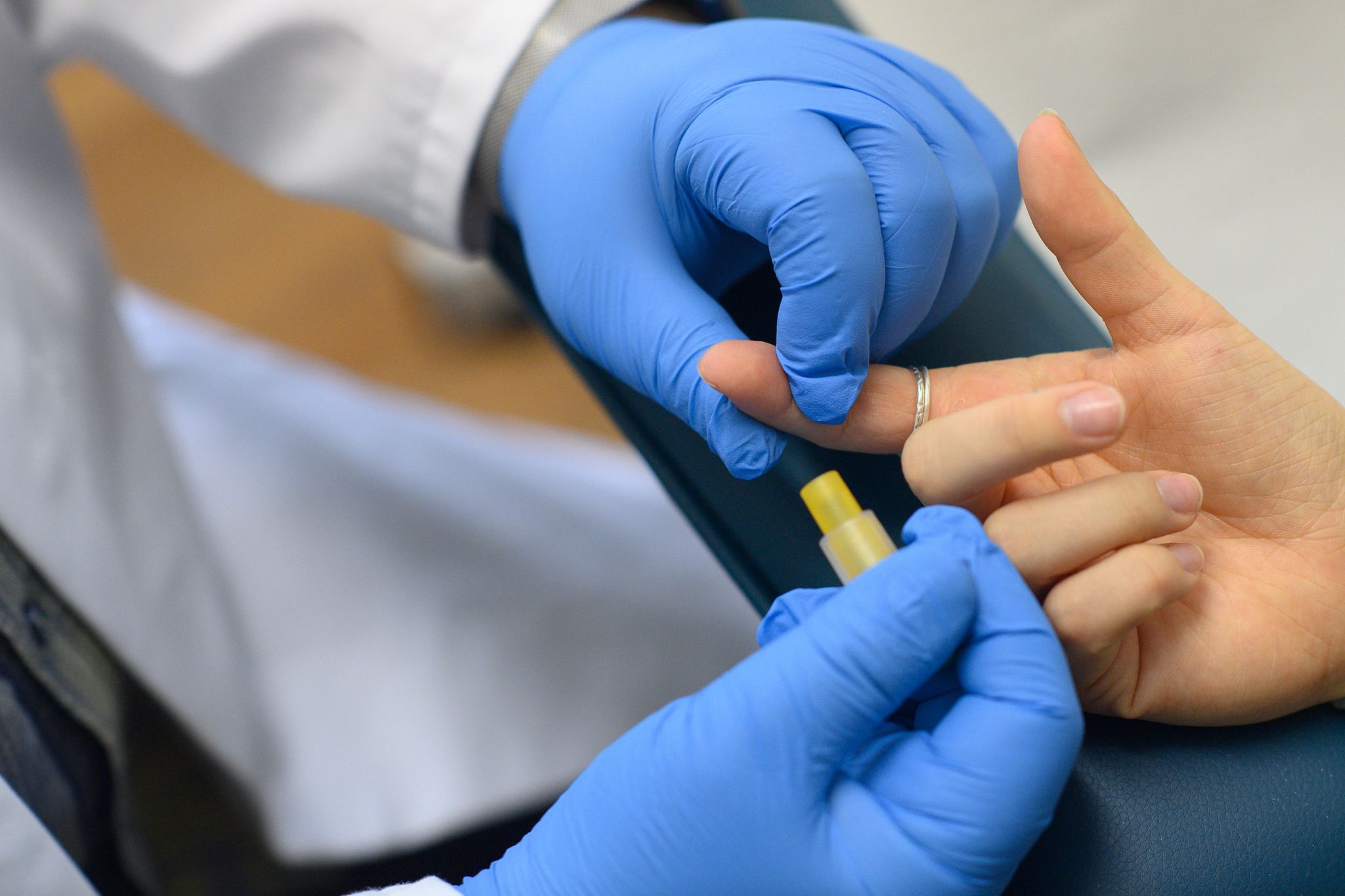 Mehr nicht-diagnostizierte HIV-Fälle in Europa