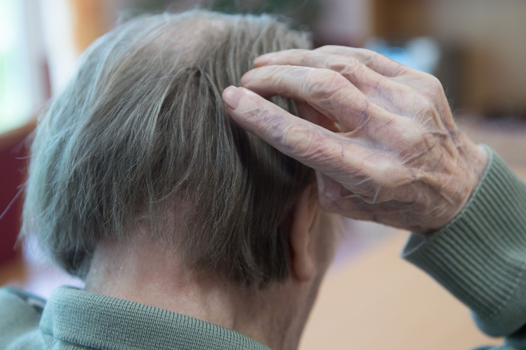 Neues Medikament: Fortschritt bei Alzheimer-Therapie