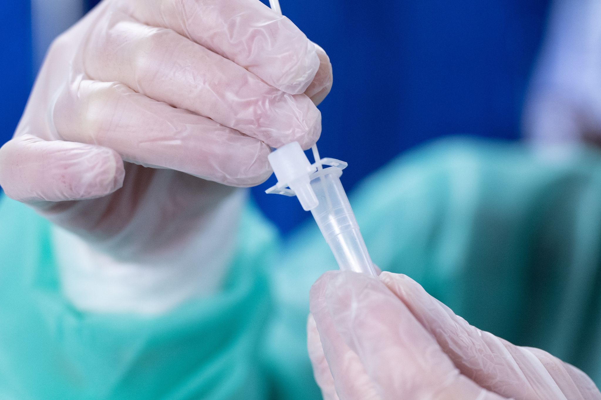 Kostenlose Corona-Tests künftig nicht mehr fürs Freitesten