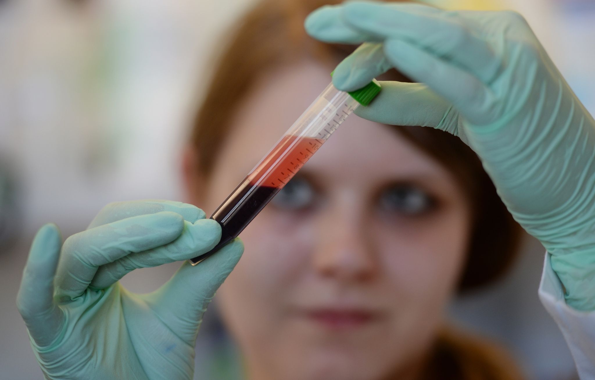 Bluttest auf Trisomien: Was werdende Eltern wissen sollten