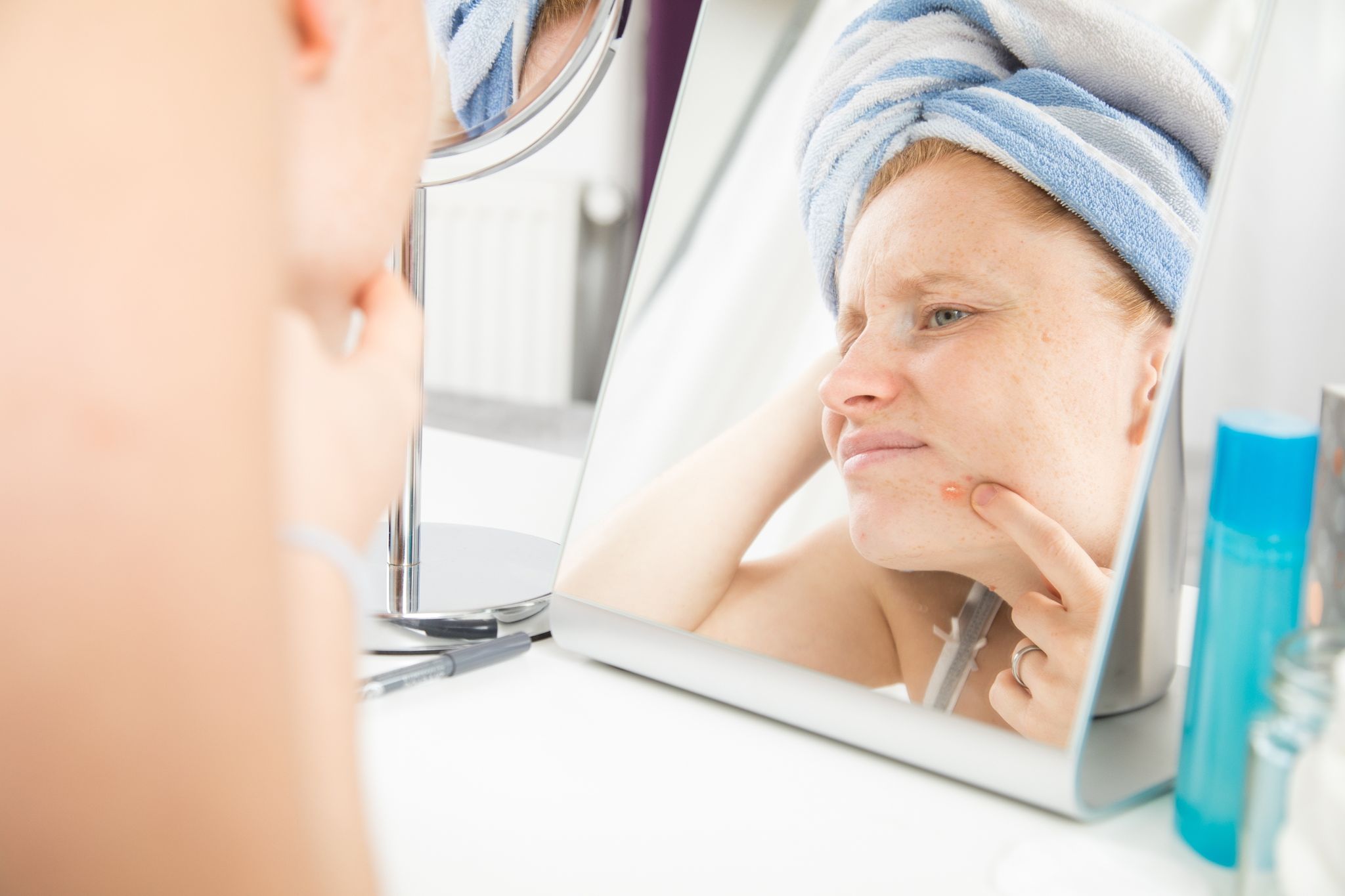 Skin Picking betrifft Haut und Psyche