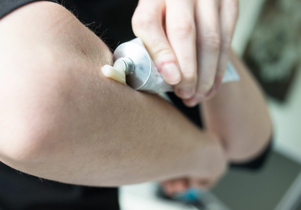 Schmerzsalben im «Öko-Test»: 8 von 20 fallen durch