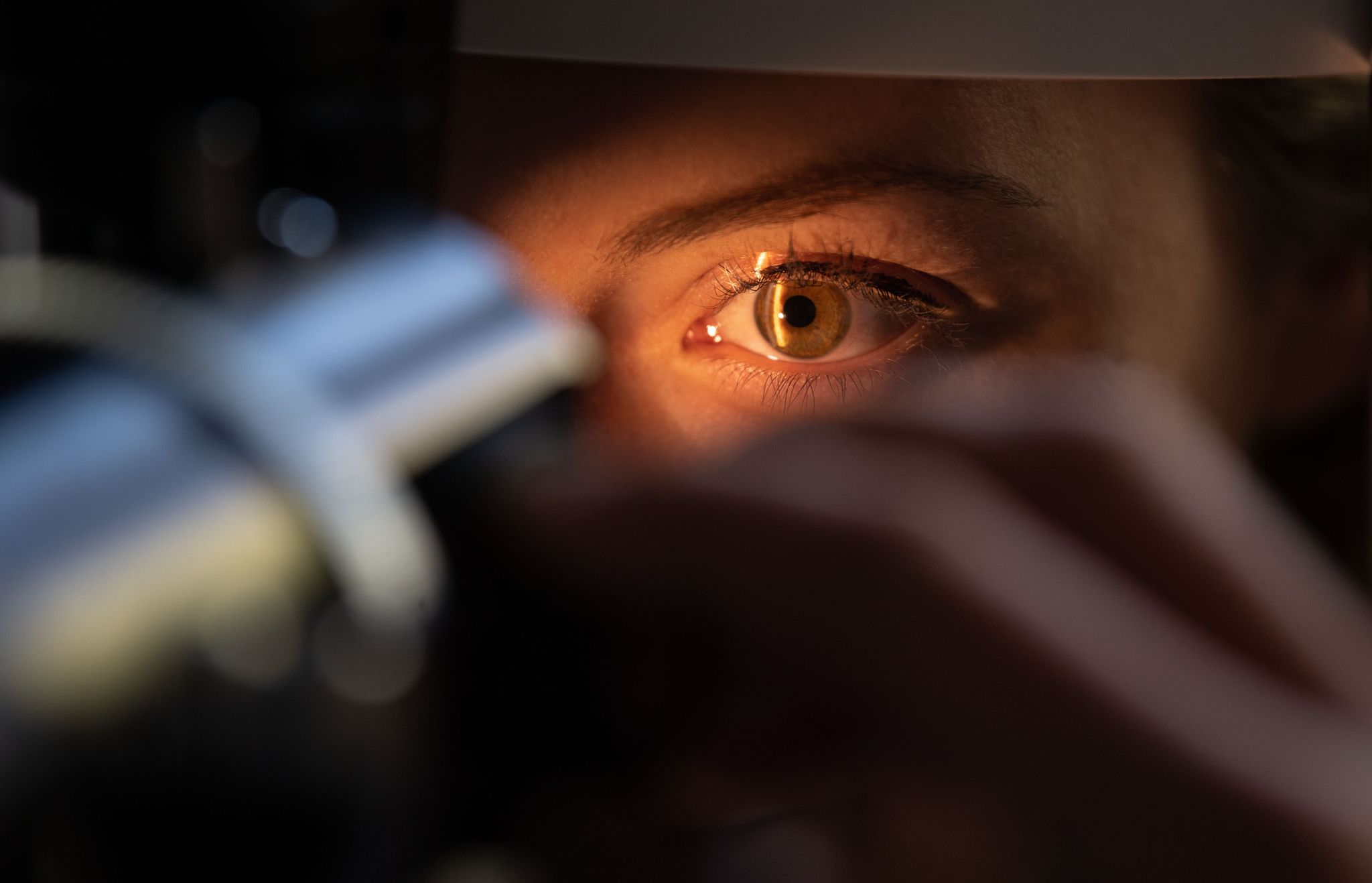 Bei Bluthochdruck: Augen-Check nicht vergessen