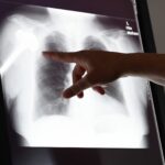 Verdacht auf Behandlungsfehler? Das können Sie nun tun