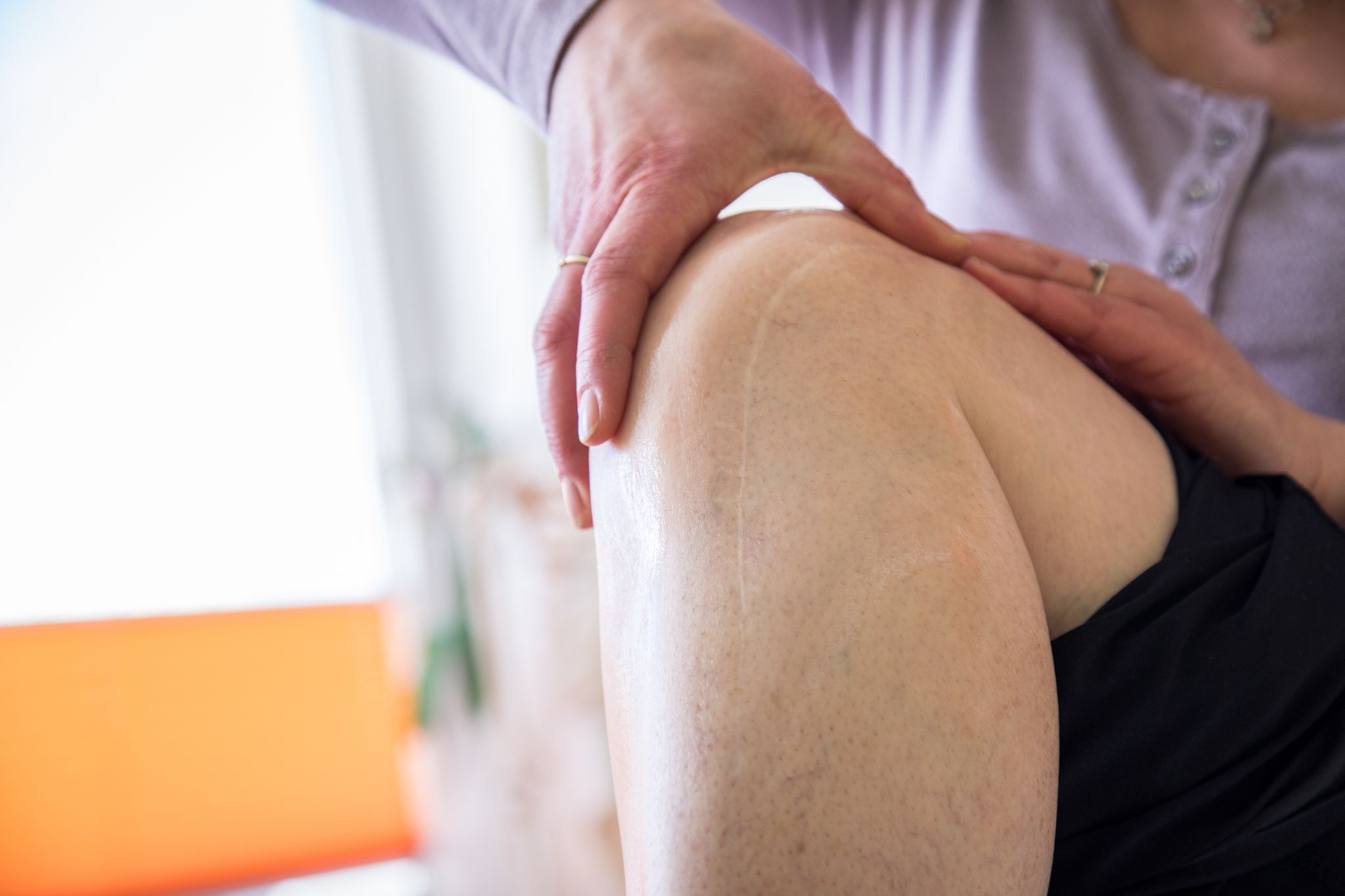 Was hilft, wenn mich das Aussehen einer Narbe belastet?