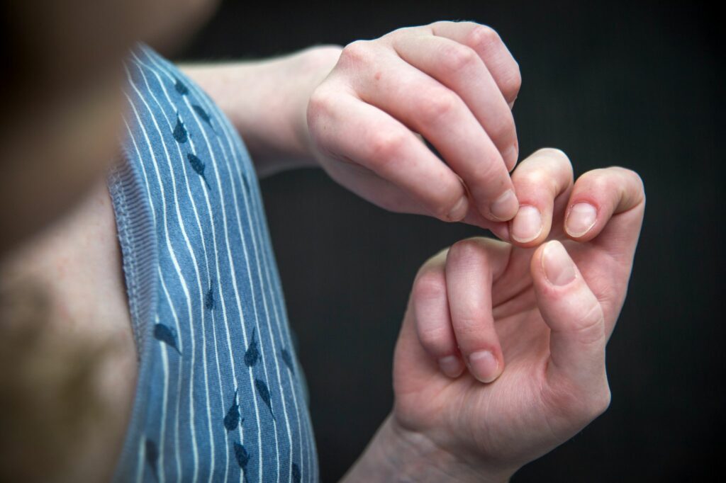 Nägelkauen, Hautzupfen & Co: Wie man besser damit leben kann