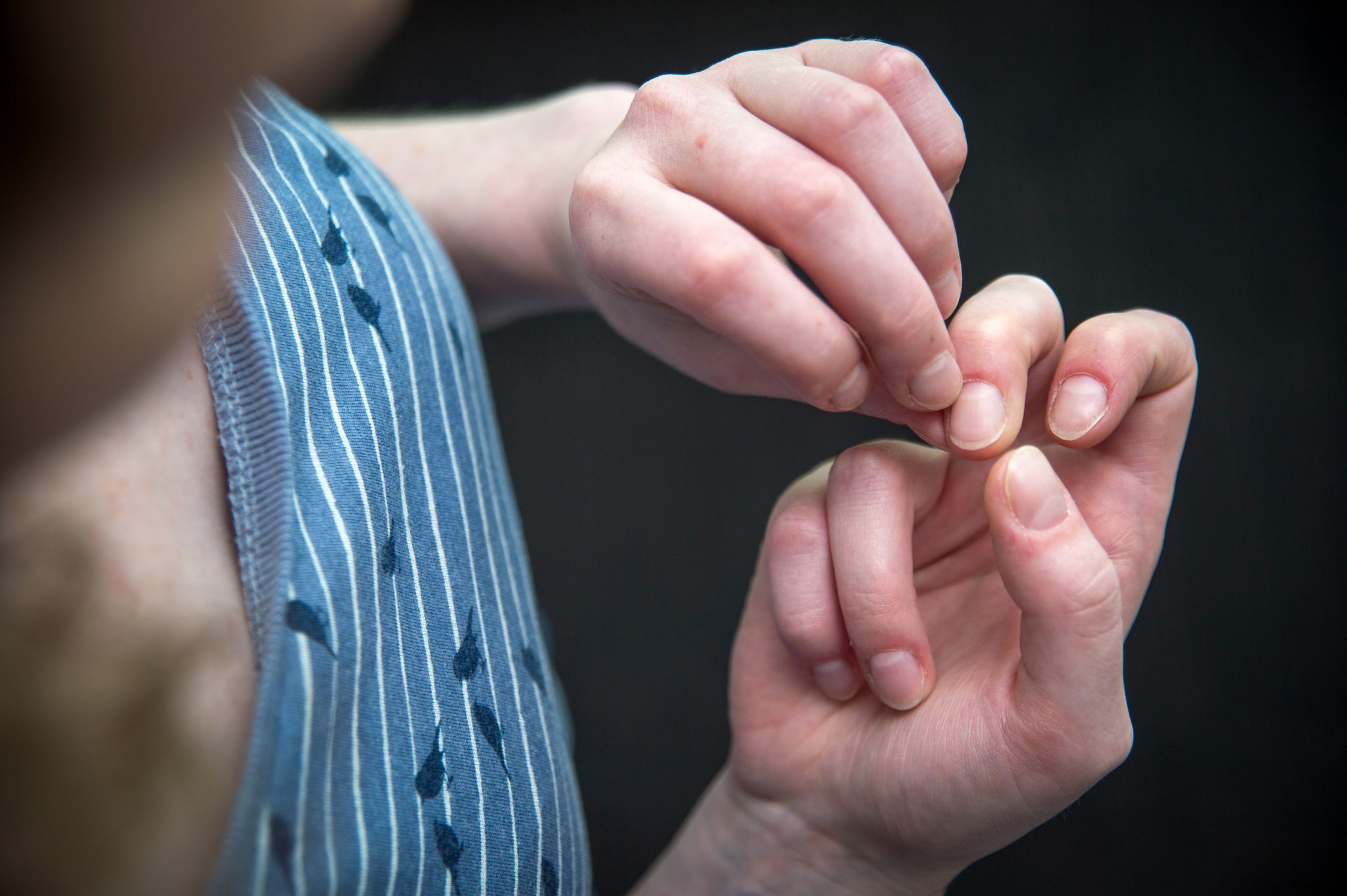 Nägelkauen, Hautzupfen & Co: Wie man besser damit leben kann