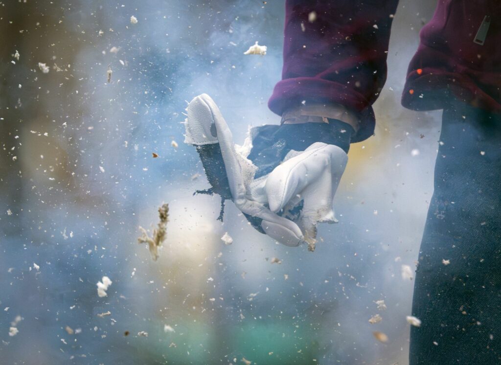 Verletzt durch Böller oder Rakete? So geht Erste Hilfe