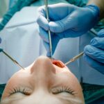 Wie man die Tage nach einer Weisheitszahn-OP gut übersteht