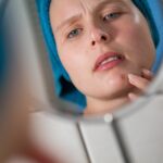 Finger weg! Wie Pickel entstehen – und gut wieder abheilen