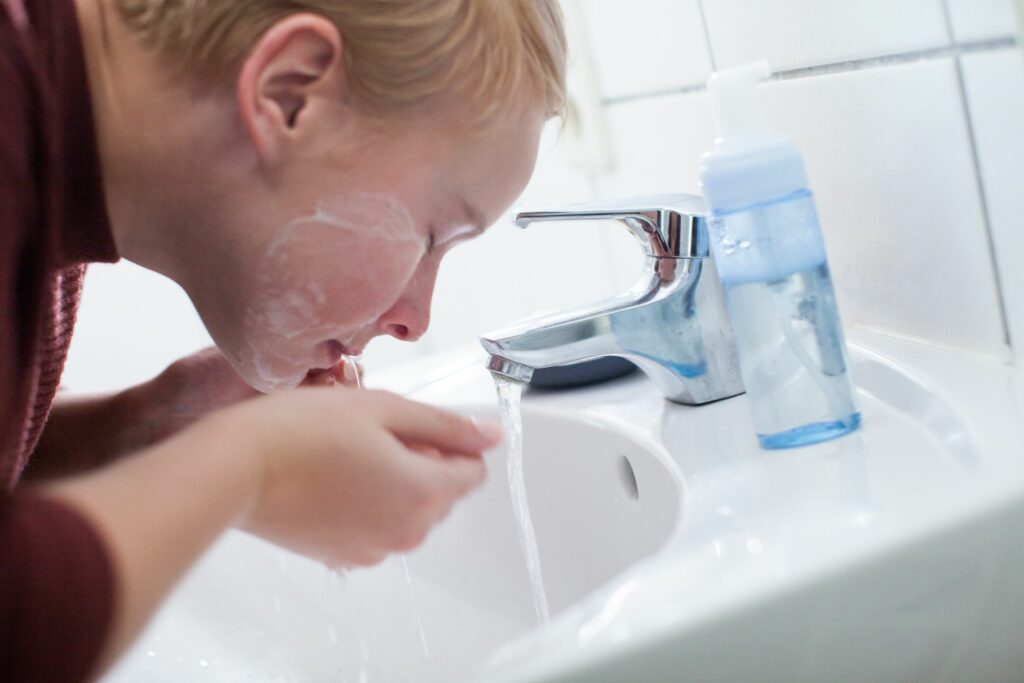 So können wir Pickeln vorbeugen